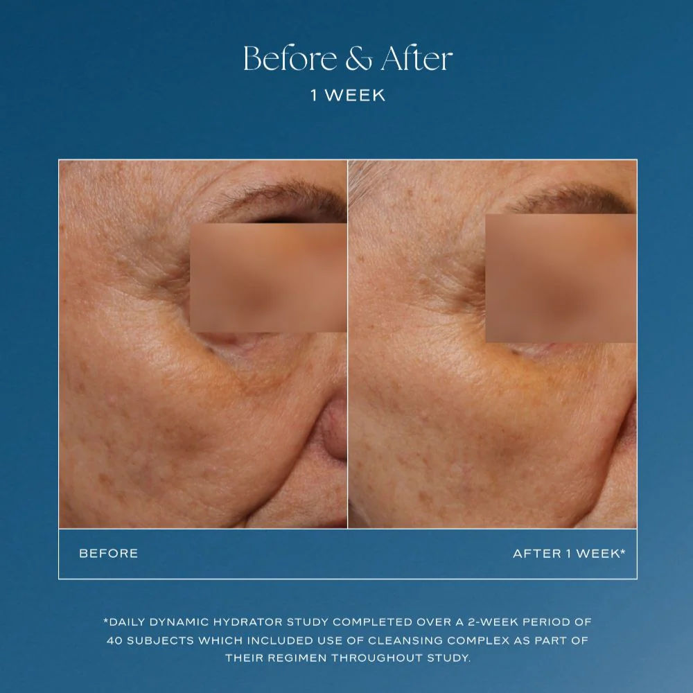 Before and after results of using IS Clinical Daily Dynamic Hydrator