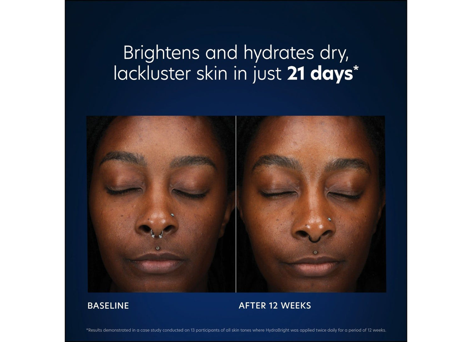 Before and after results of using PCA Skin HydraBright Moisturizer