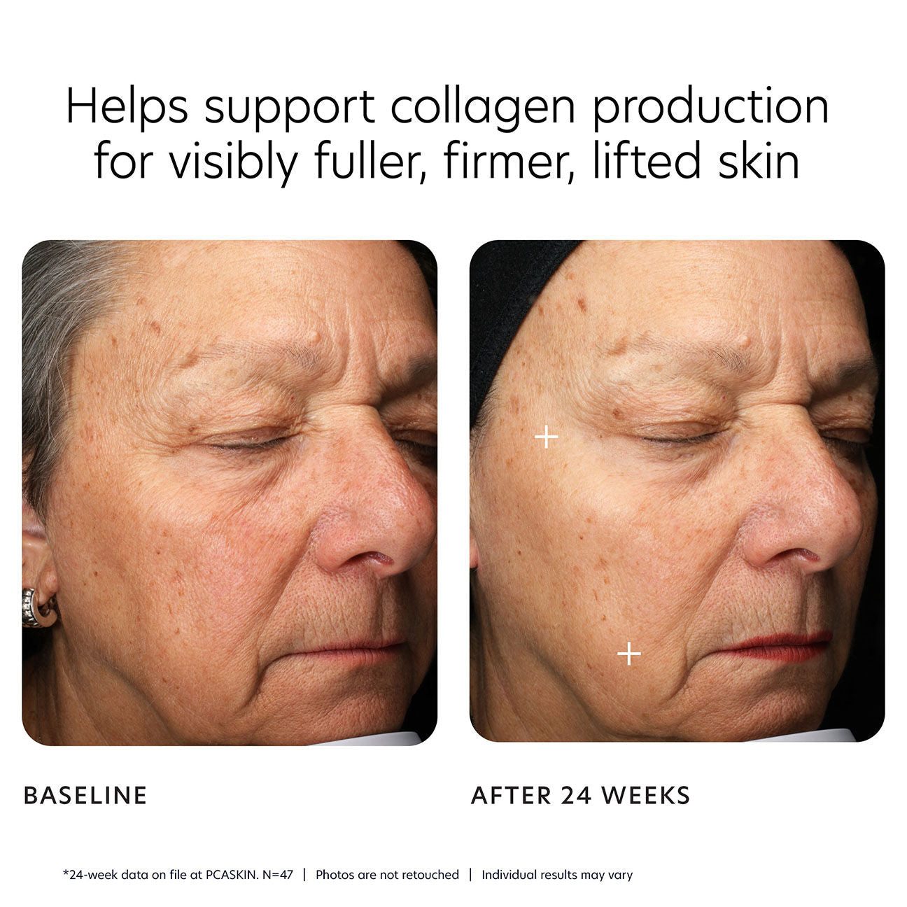 Before and after results of using PCA Skin MGF Age Renewal Cream