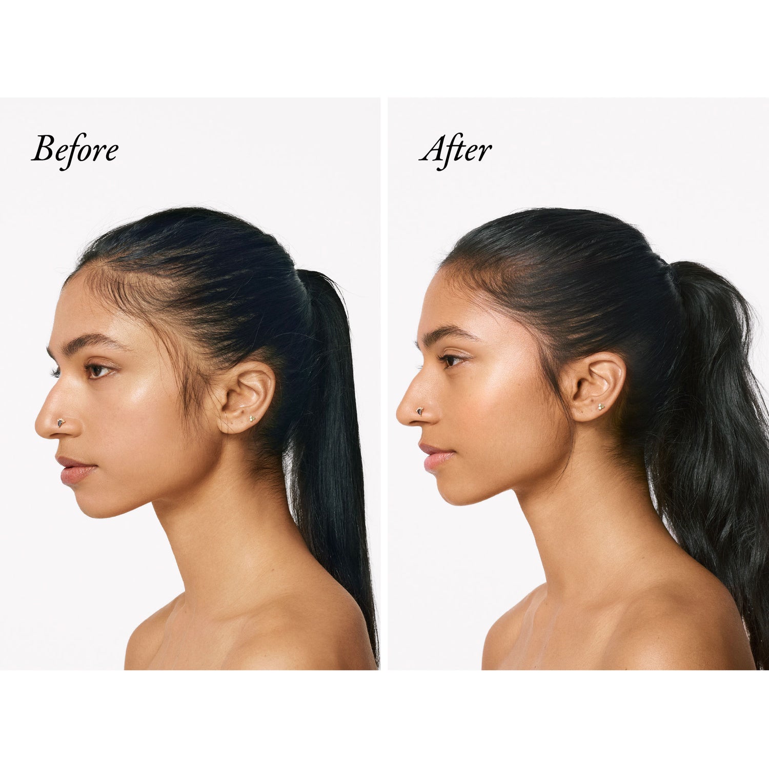 Before and after results of using Oribe Serene Scalp Densifying Treatment Spray