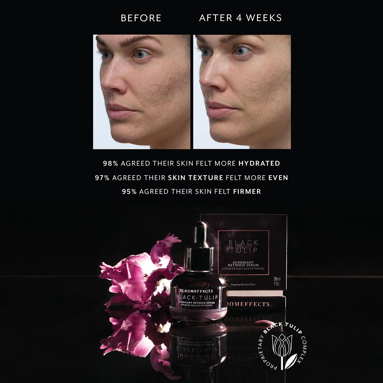 Before and after results of using Bloomeffects Black Tulip Overnight Retinoid Serum