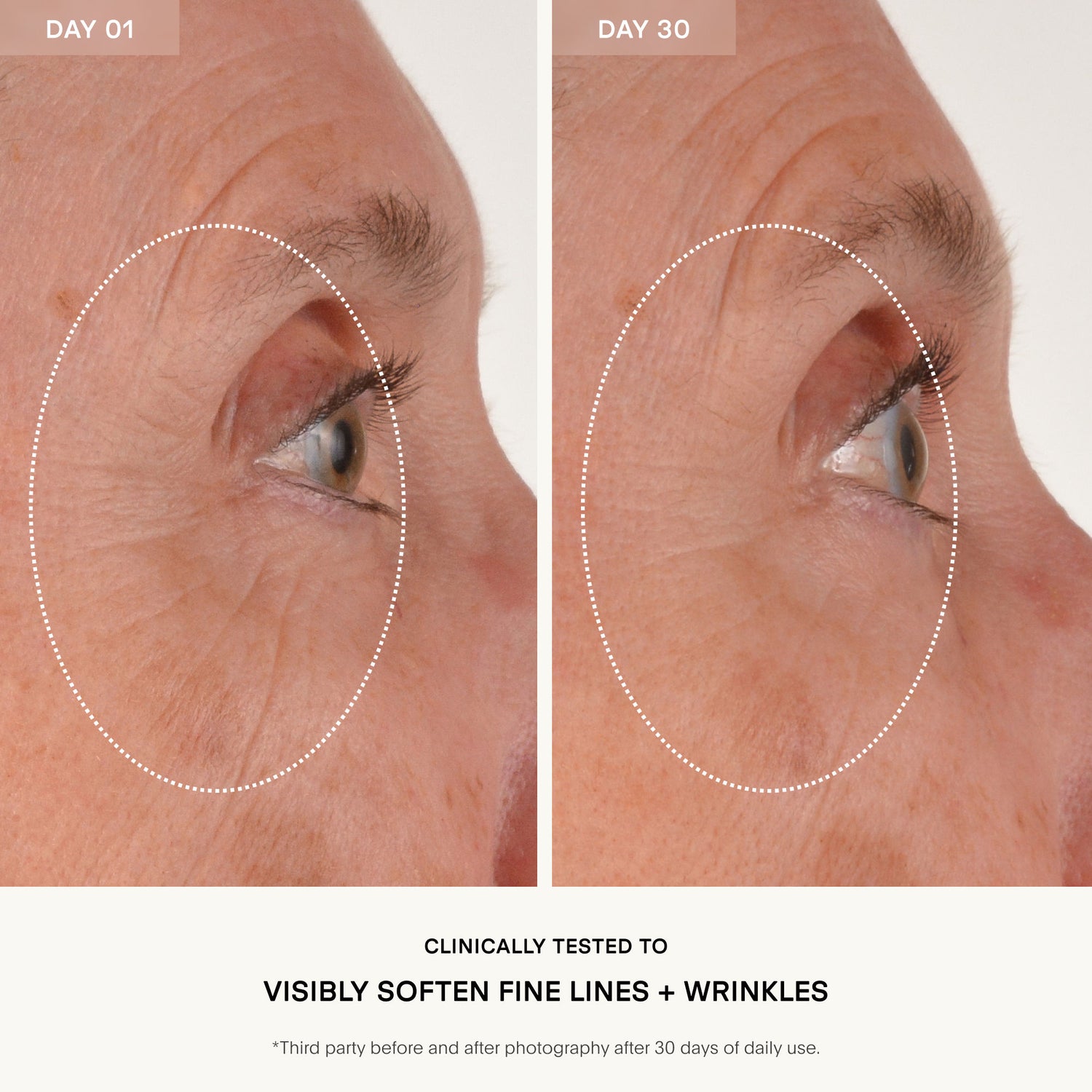 Before and after results of using U Beauty The Return Eye Concentrate