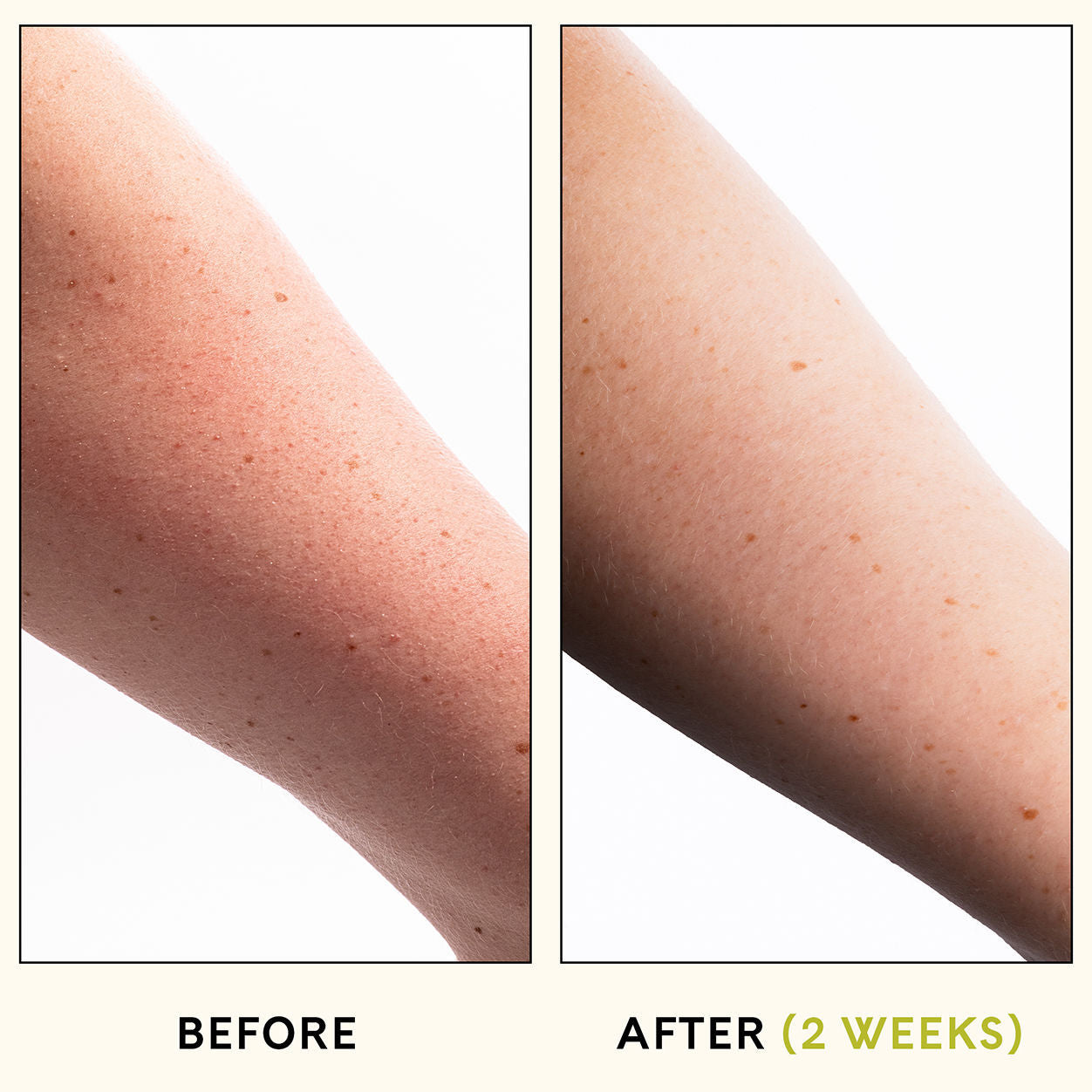 Before and after results of using Fur KP Body Scrub