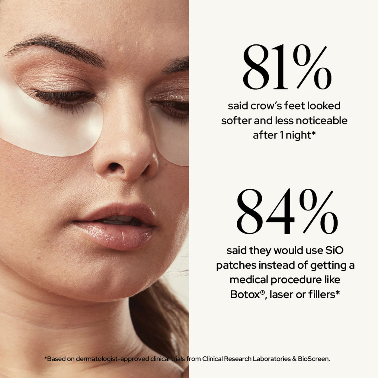 Information related to SIO Super EyeLift