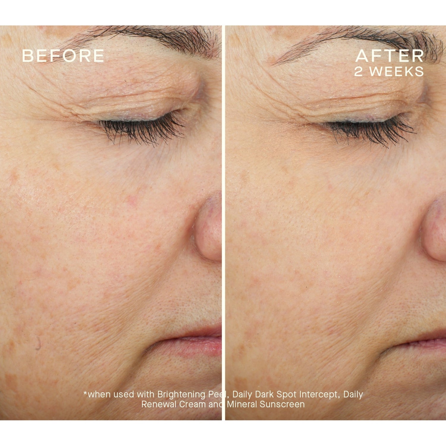 Ourself Brightening Peel Kit before and after image .