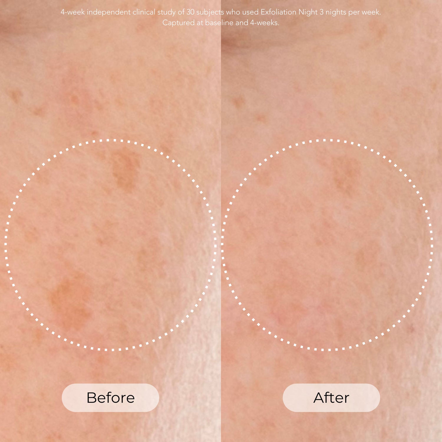 Before and after results of using Dr. Whitney Bowe Beauty Skin Cycling Program