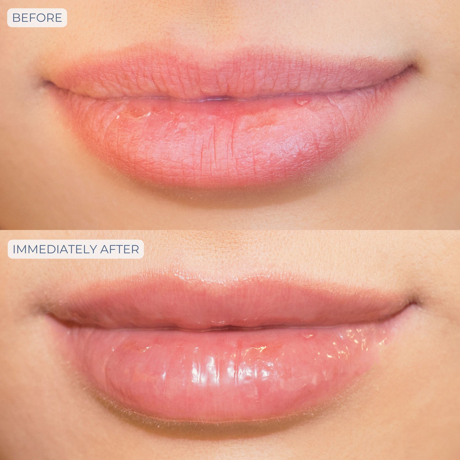 Before and after results of using Dr. Whitney Bowe Beauty Tri-Liptide Peptide Lip Enhancing Treatment