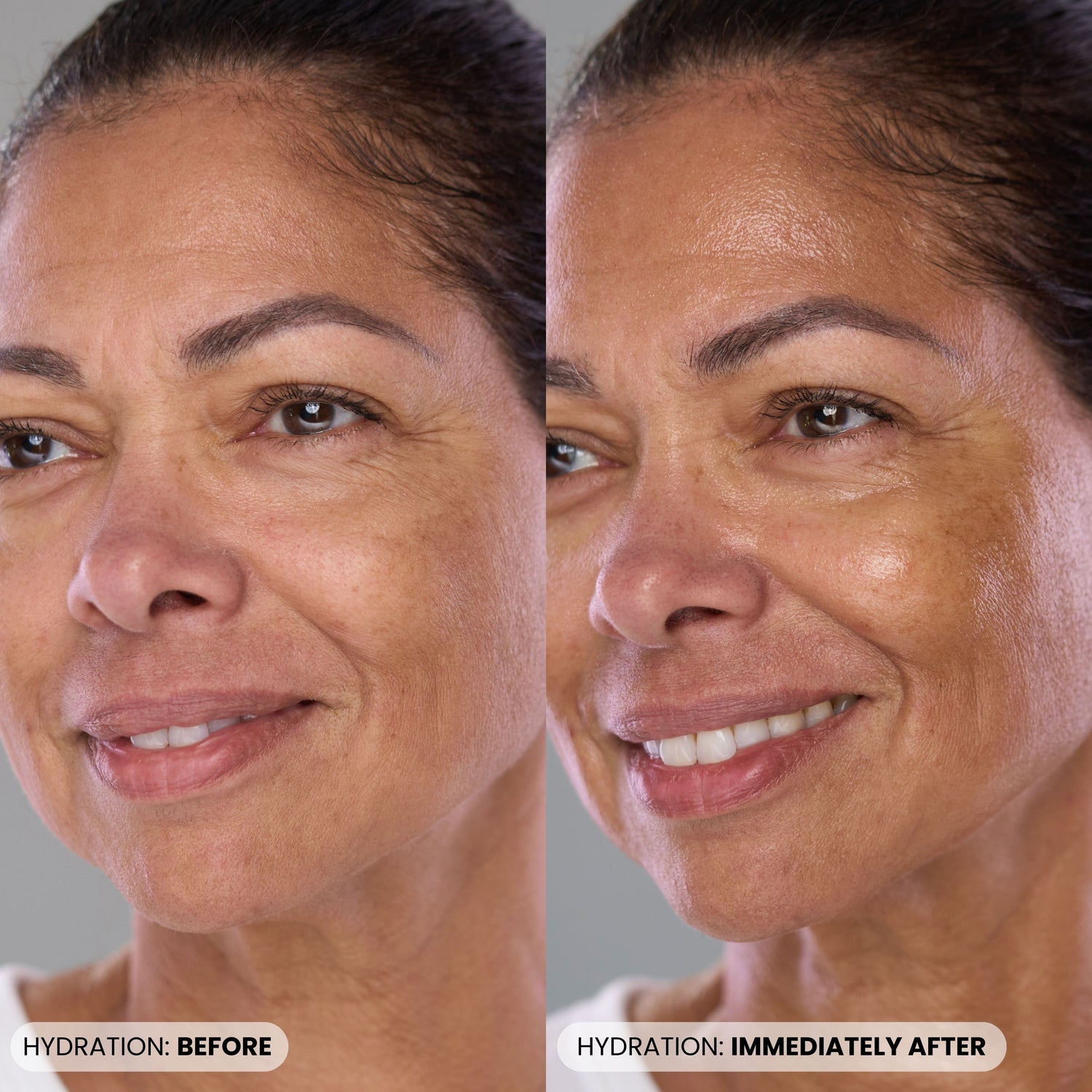 Before and after results of using Dr. Whitney Bowe Beauty P46 Peptide + HA Plumping Serum