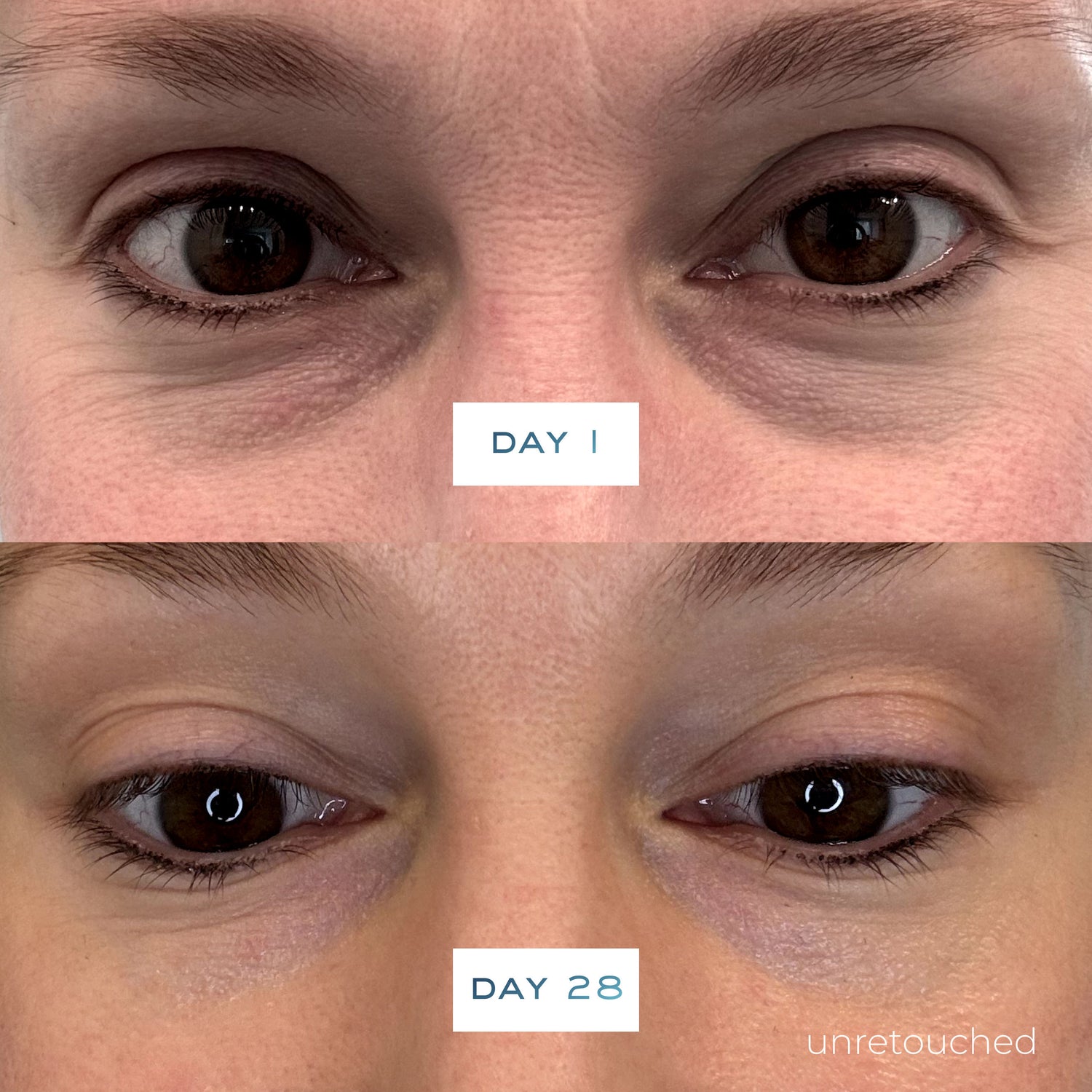 Before and after results of using Element Eight O2 Vitamin C Brighten Defend Serum