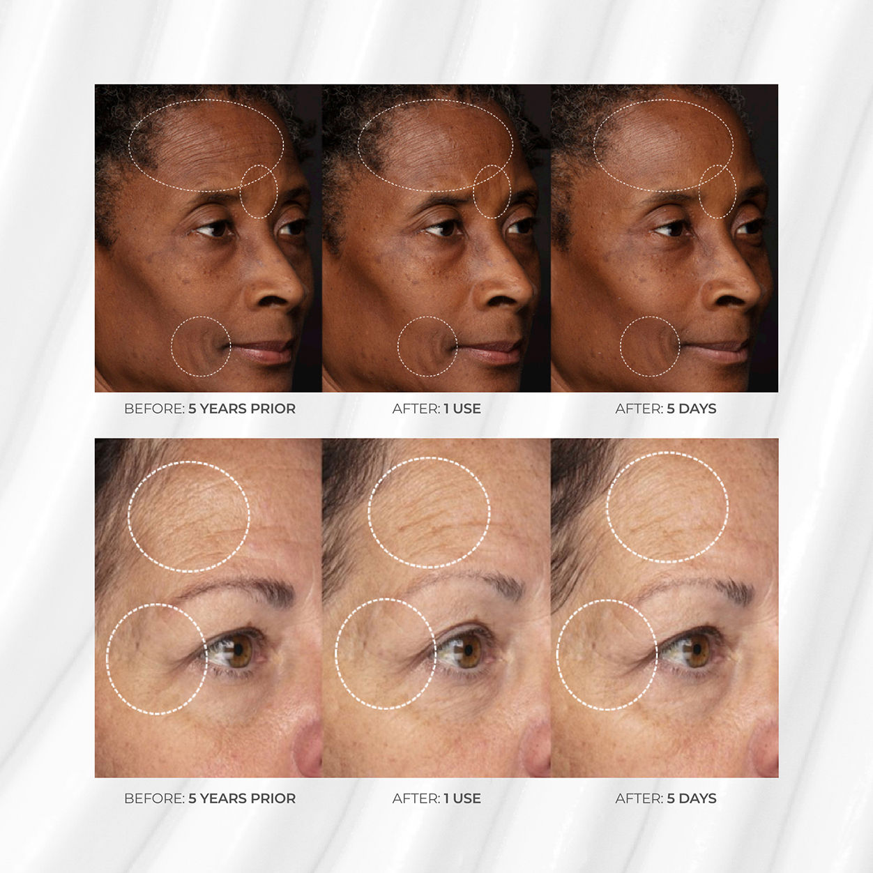 Before and after results of using BeautyStat Peptide Wrinkle Relaxing Moisturizer