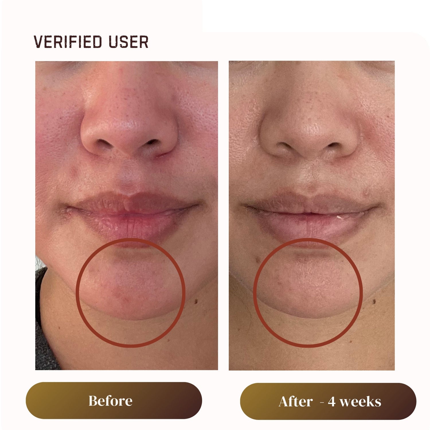 Before and after results of using Plantkos Replenishing Essence