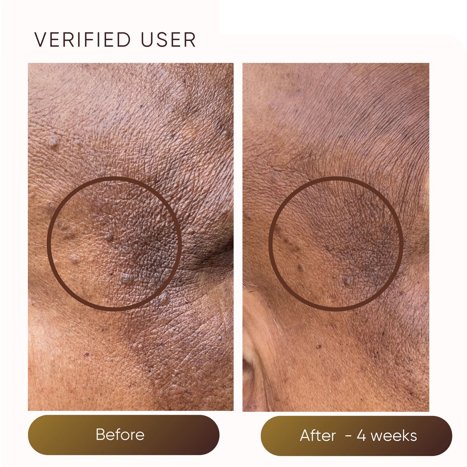Before and after results of using Plantkos Hydrating Moisturizer