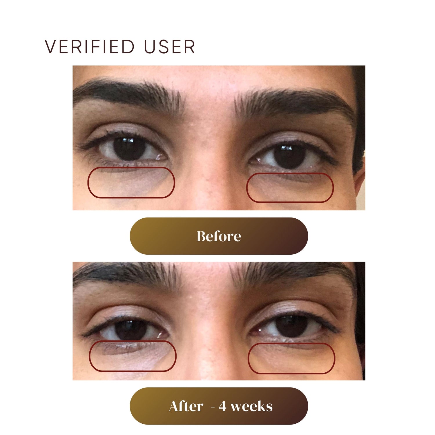 Before and after results of using Plantkos Revitalizing Eye Cream