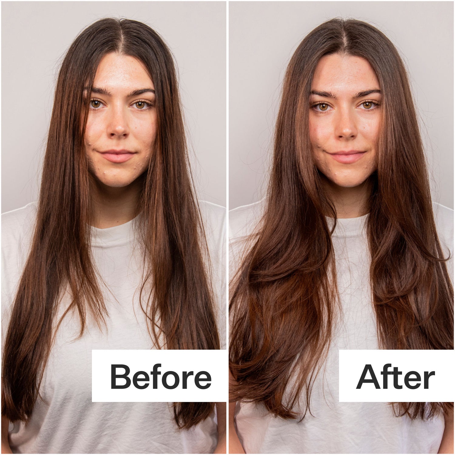 Before and after results of using Act+Acre 4% Niacinamide Oily Scalp Serum