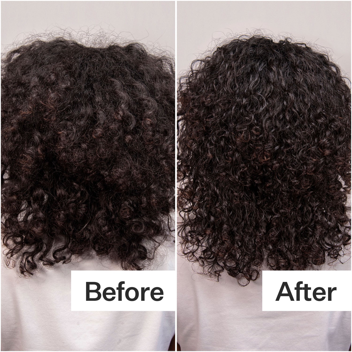 Before and after results of using Act+Acre Daily Hydro Scalp Serum with Hyaluronic Acid for Dry Scalp