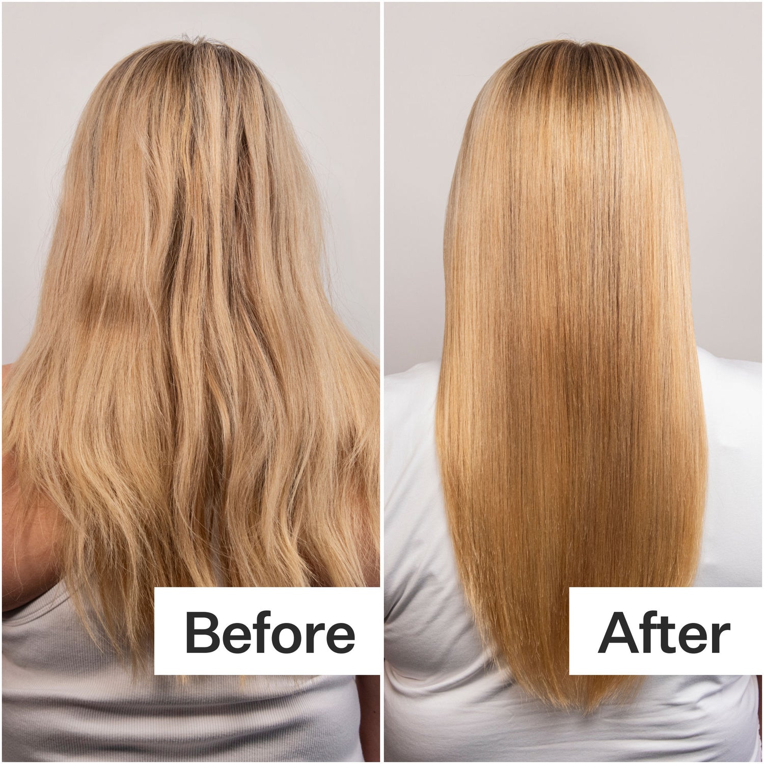 Before and after results of using Act+Acre Daily Hydro Scalp Serum with Hyaluronic Acid for Dry Scalp