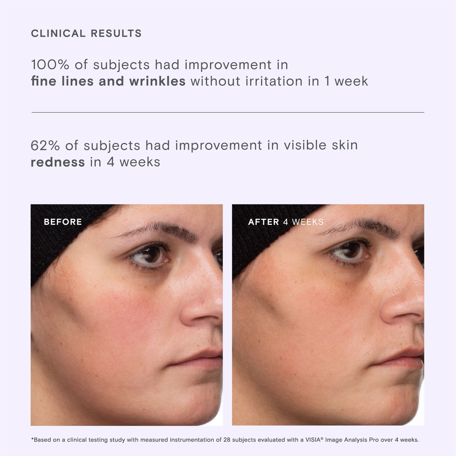 Before and after results of using Exponent Calm Revival Green Tea Resveratrol Power Serum