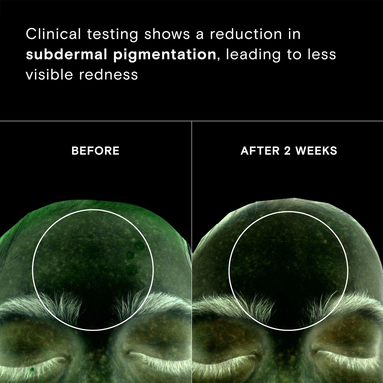 Before and after results of using Exponent Calm Revival Green Tea Resveratrol Power Serum