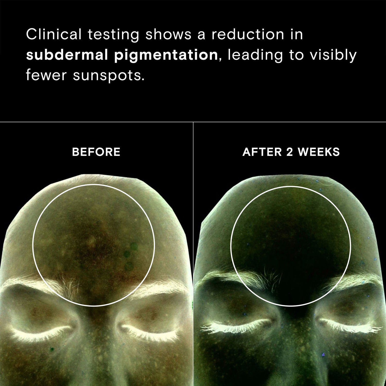 Before and after results of using Exponent Brightening Boost Vitamin C Power Serum