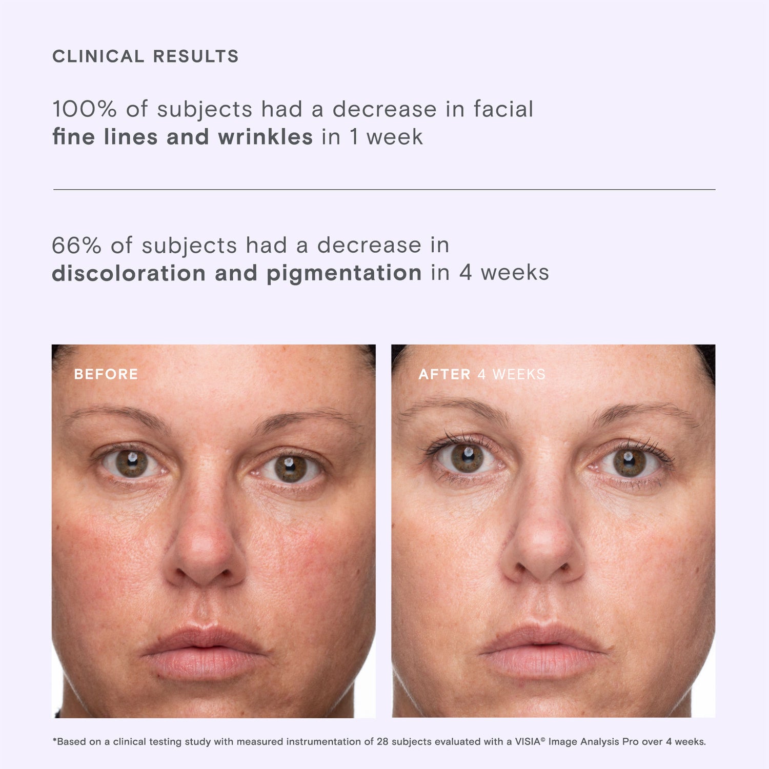 Before and after results of using Exponent Brightening Boost Vitamin C Power Serum