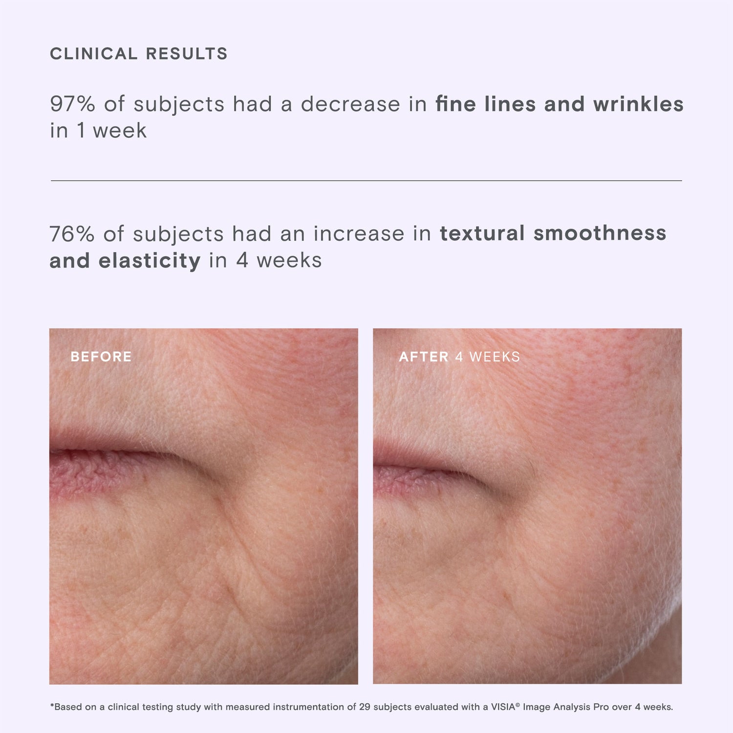 Before and after results of using Exponent Time Rewind Retinol Power Serum