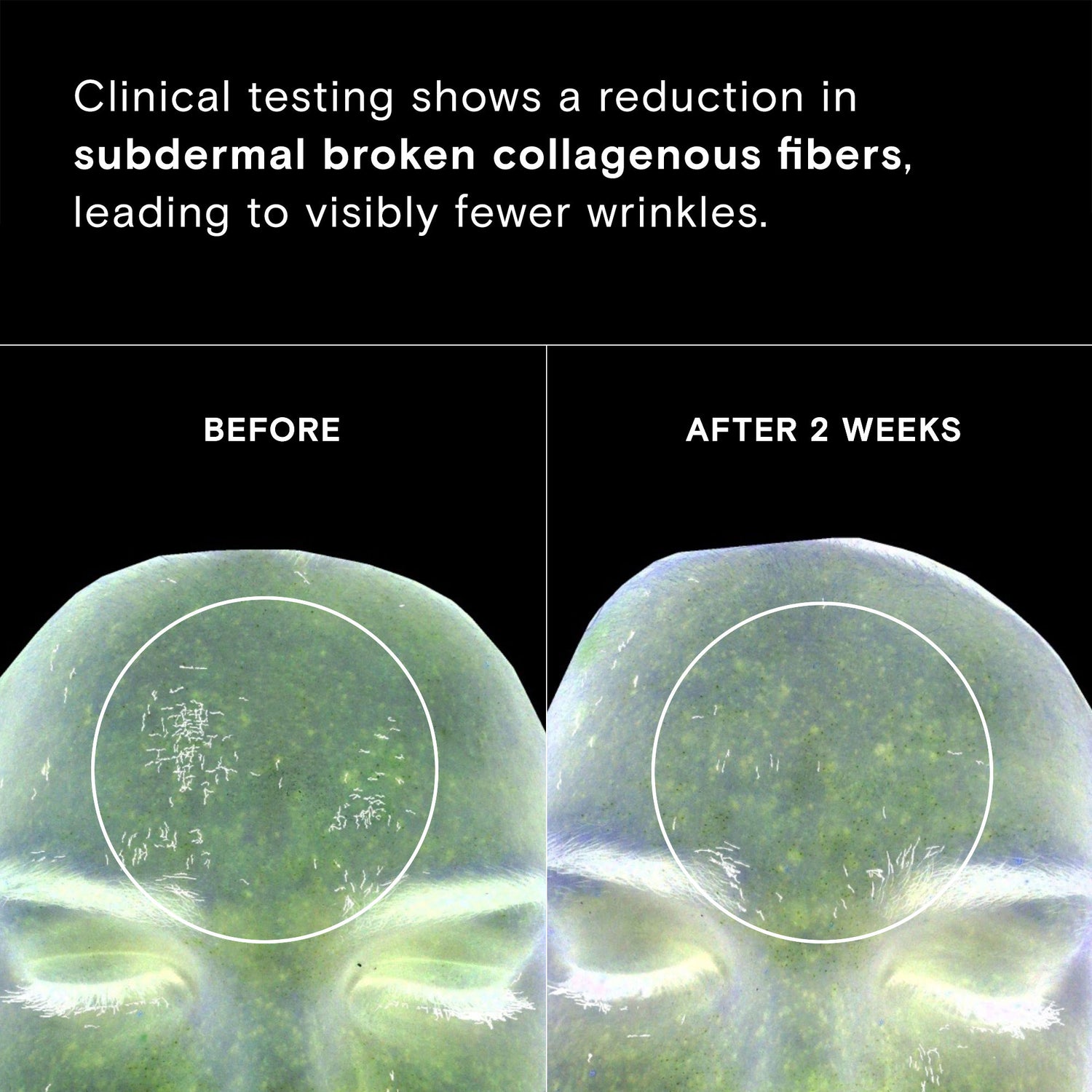 Before and after results of using Exponent Time Rewind Retinol Power Serum