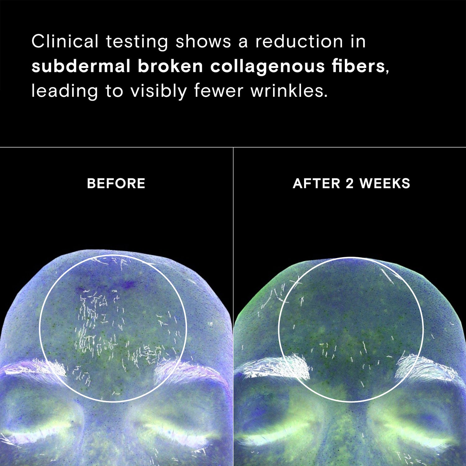 Before and after results of using Exponent Firming Filter CoQ10 Power Serum