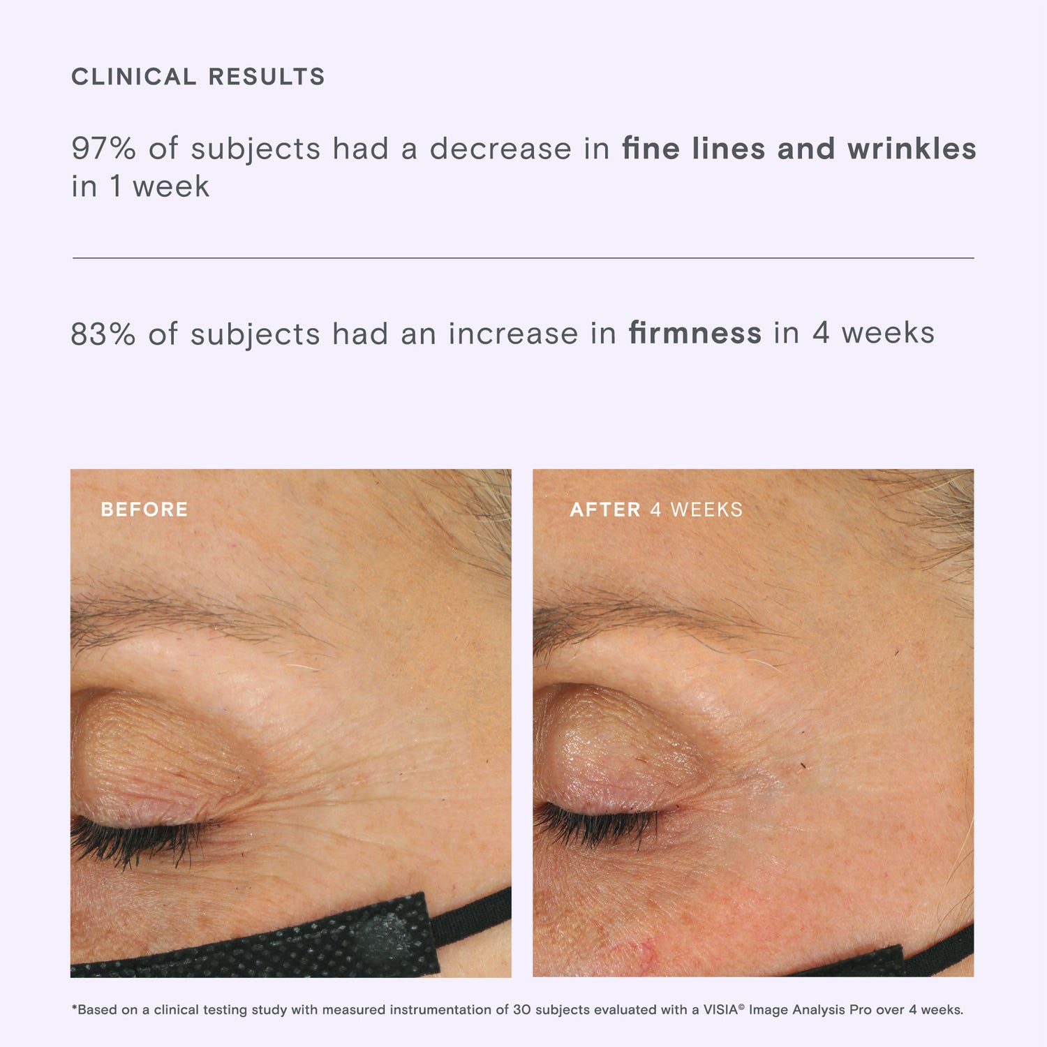 Before and after results of using Exponent Firming Filter CoQ10 Power Serum