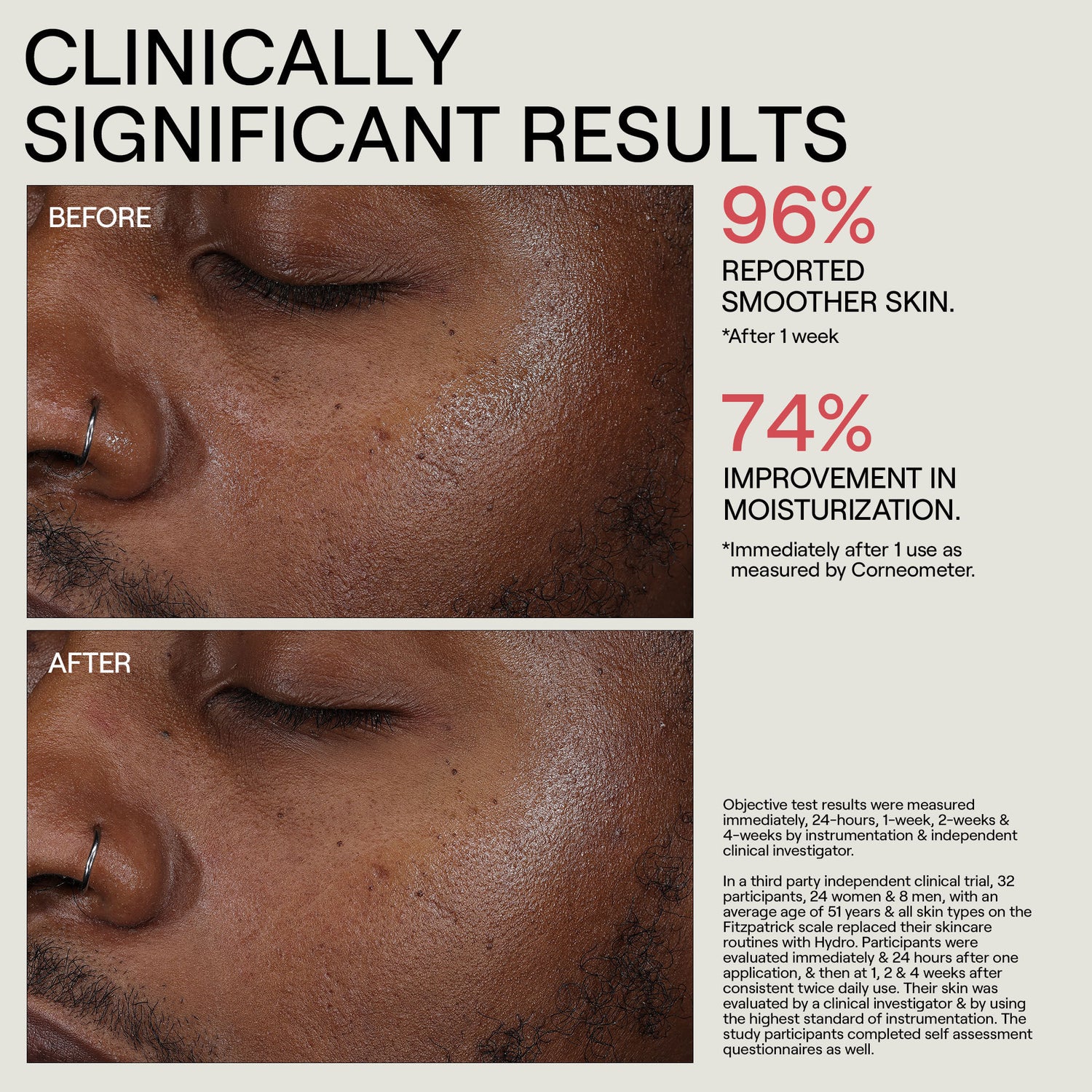 Swatch image of Dr. Diamond’s Metacine HYDR/O Bioactive Hydrolipid Barrier Moisturizer