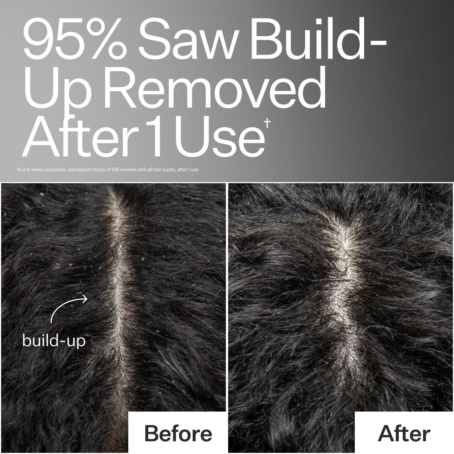Model image of Act+Acre Cold Processed Scalp Detox