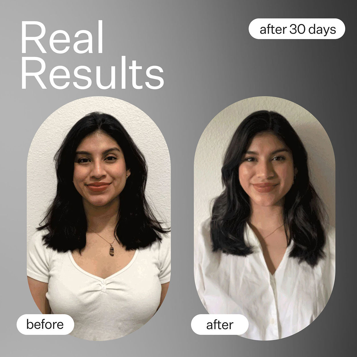 Before and after results of using Act+Acre Cold Processed Plant Based Hair Capsules