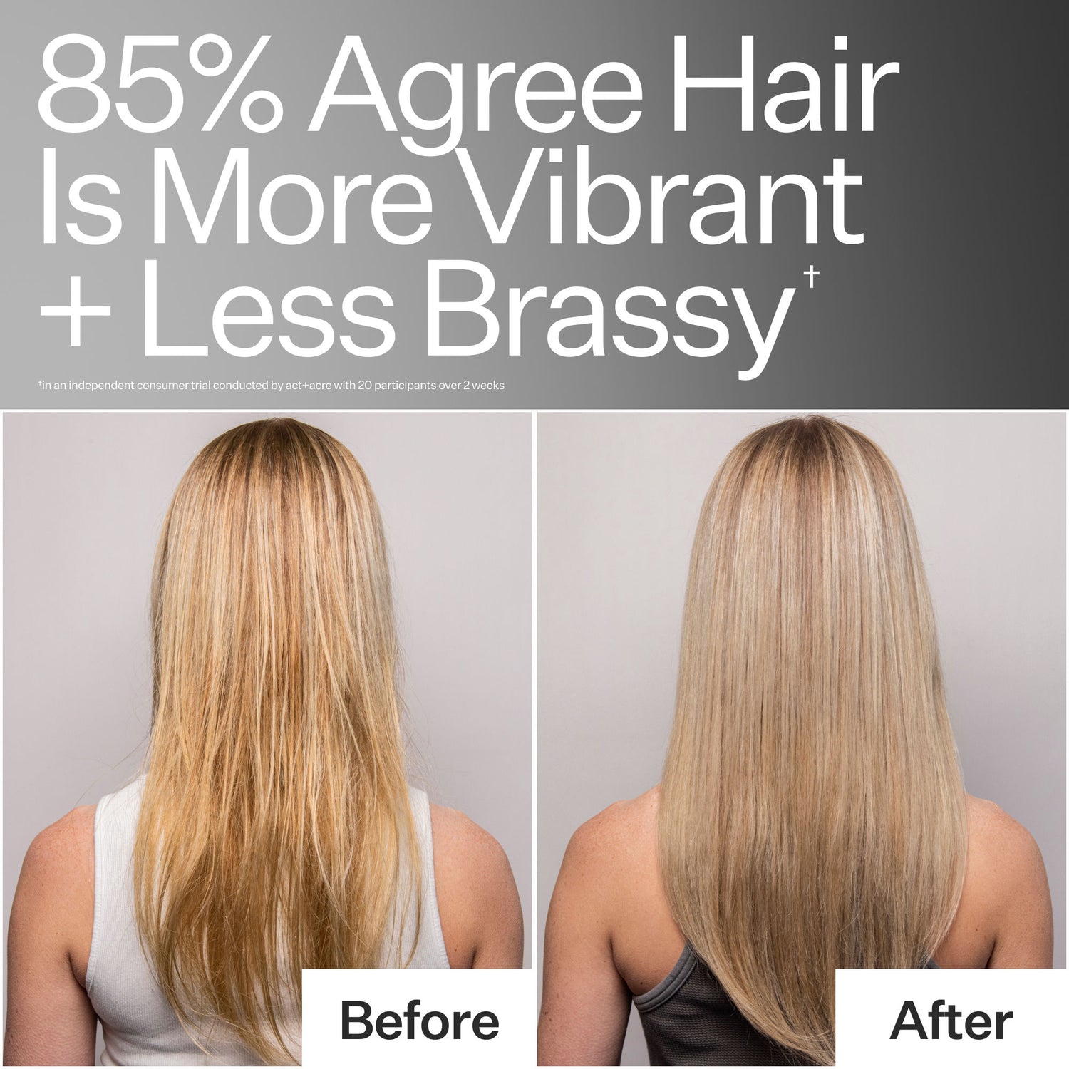 Before and after results of using Act+Acre Clarifying Hard Water Scalp Treatment For Scalp + Hair Build-Up