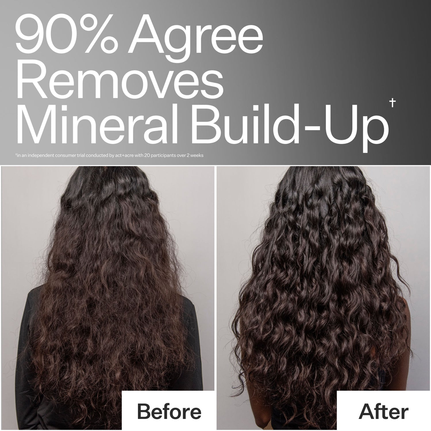Before and after results of using Act+Acre Clarifying Hard Water Scalp Treatment For Scalp + Hair Build-Up