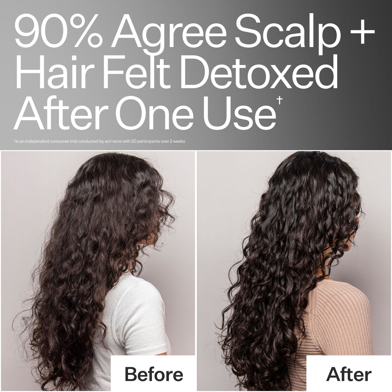 Before and after results of using Act+Acre Clarifying Hard Water Scalp Treatment For Scalp + Hair Build-Up