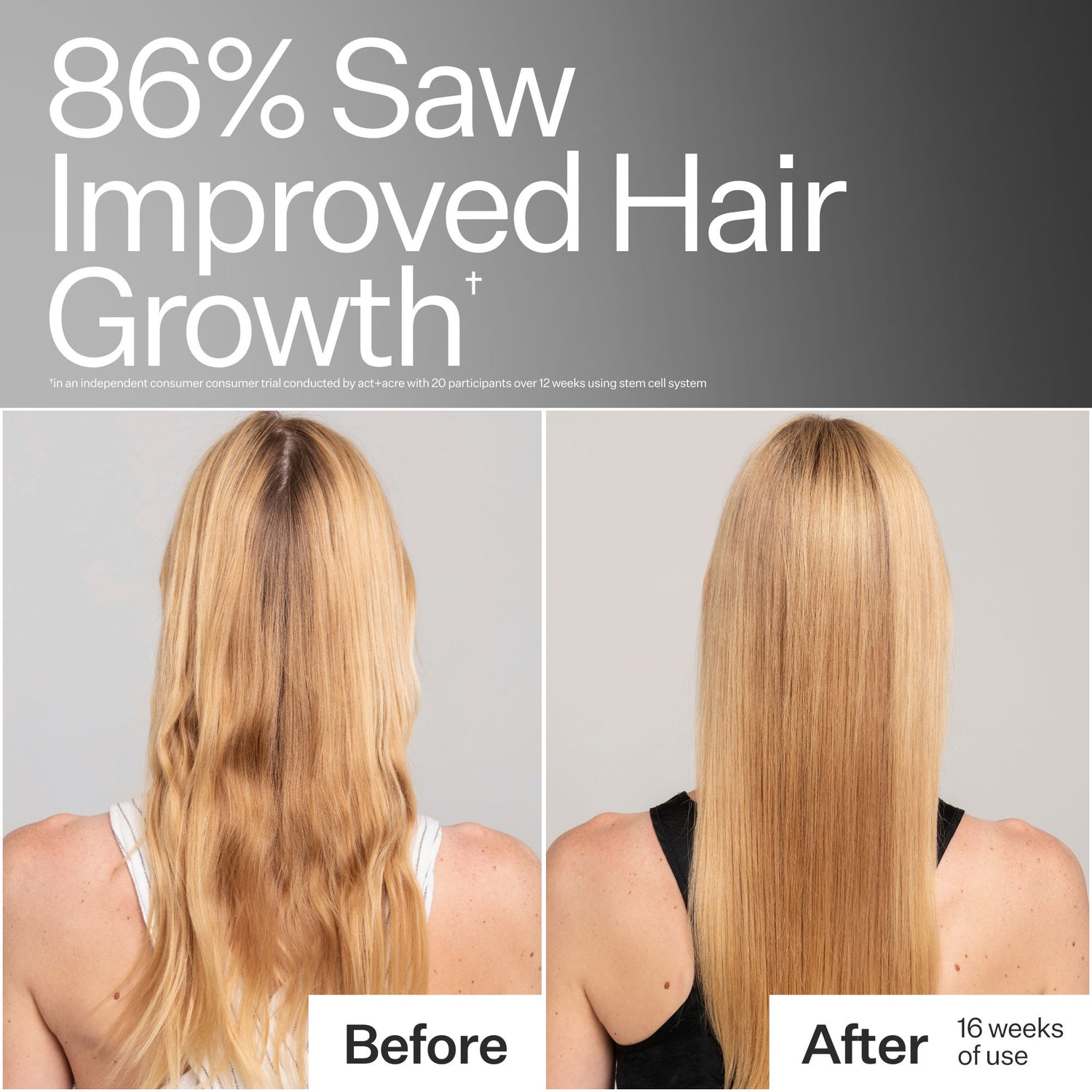 Before and after results of using Act+Acre Stem Cell Conditioner For Thicker Fuller-Looking Hair