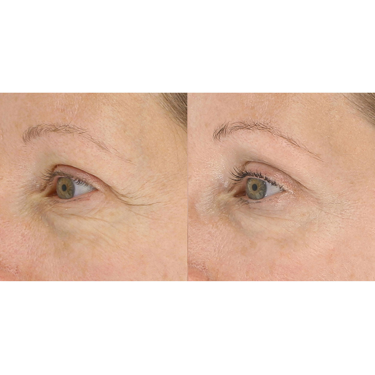 Model image of LightStim LightStim for Wrinkles