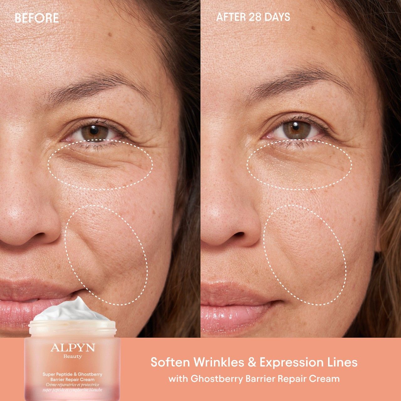 Before and after results of using Alpyn Beauty Super Peptide and Ghostberry Barrier Repair Cream