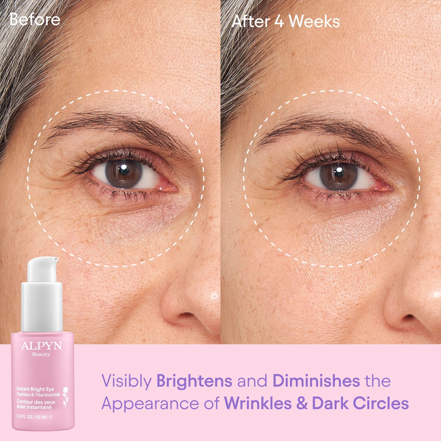 Before and after results of using Alpyn Beauty Instant Bright Eye with Peptides and Niacinamide