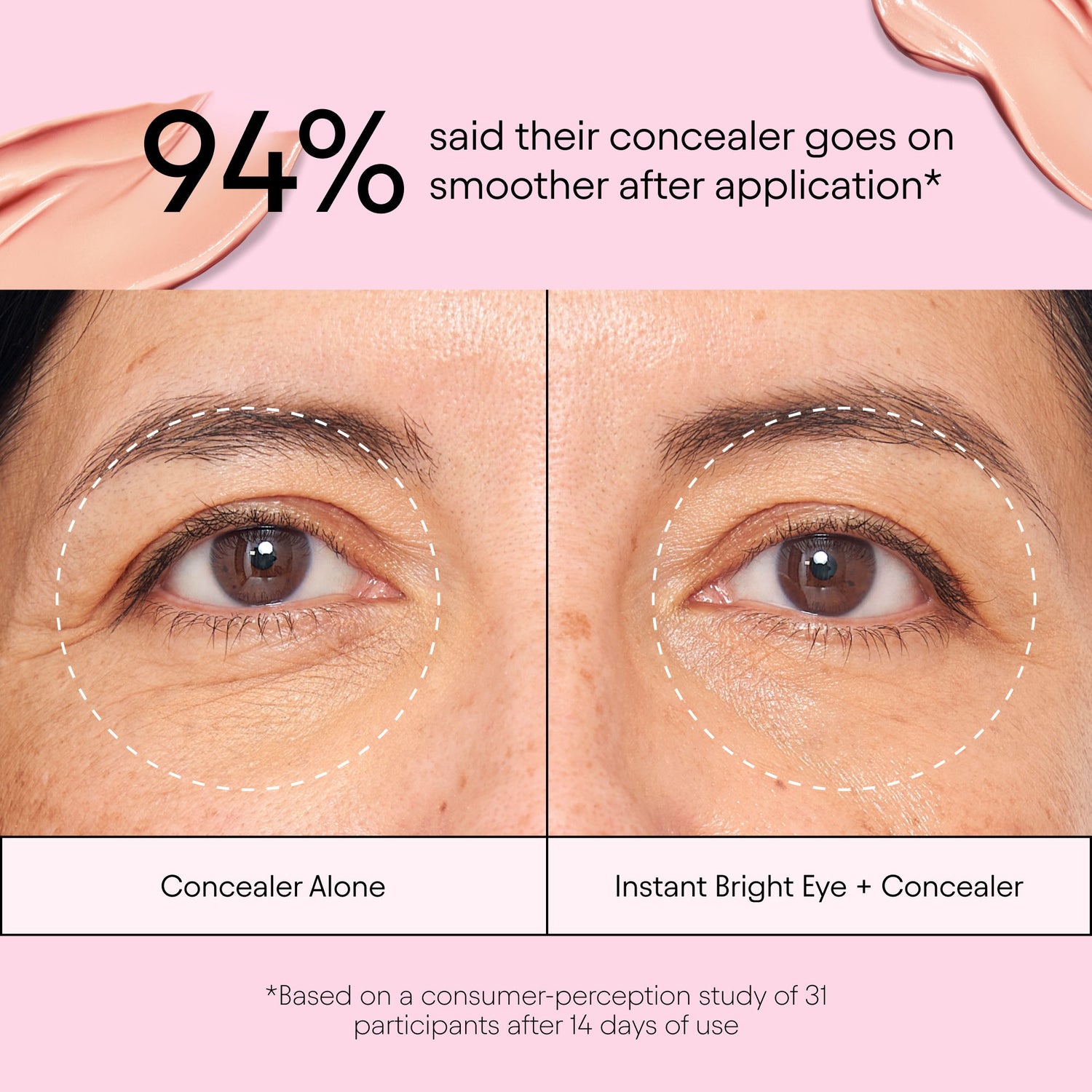 Before and after results of using Alpyn Beauty Instant Bright Eye with Peptides and Niacinamide