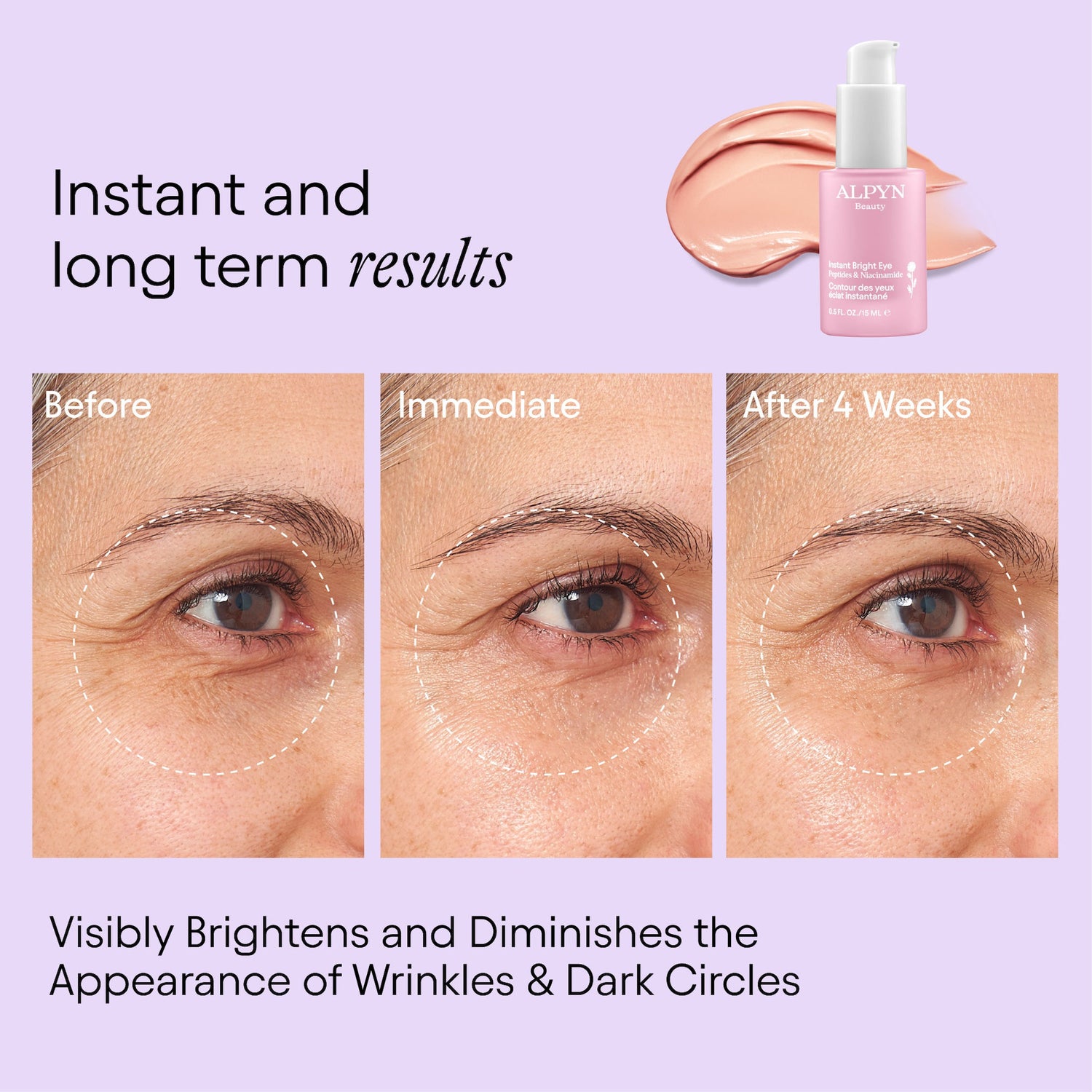 Before and after results of using Alpyn Beauty Instant Bright Eye with Peptides and Niacinamide