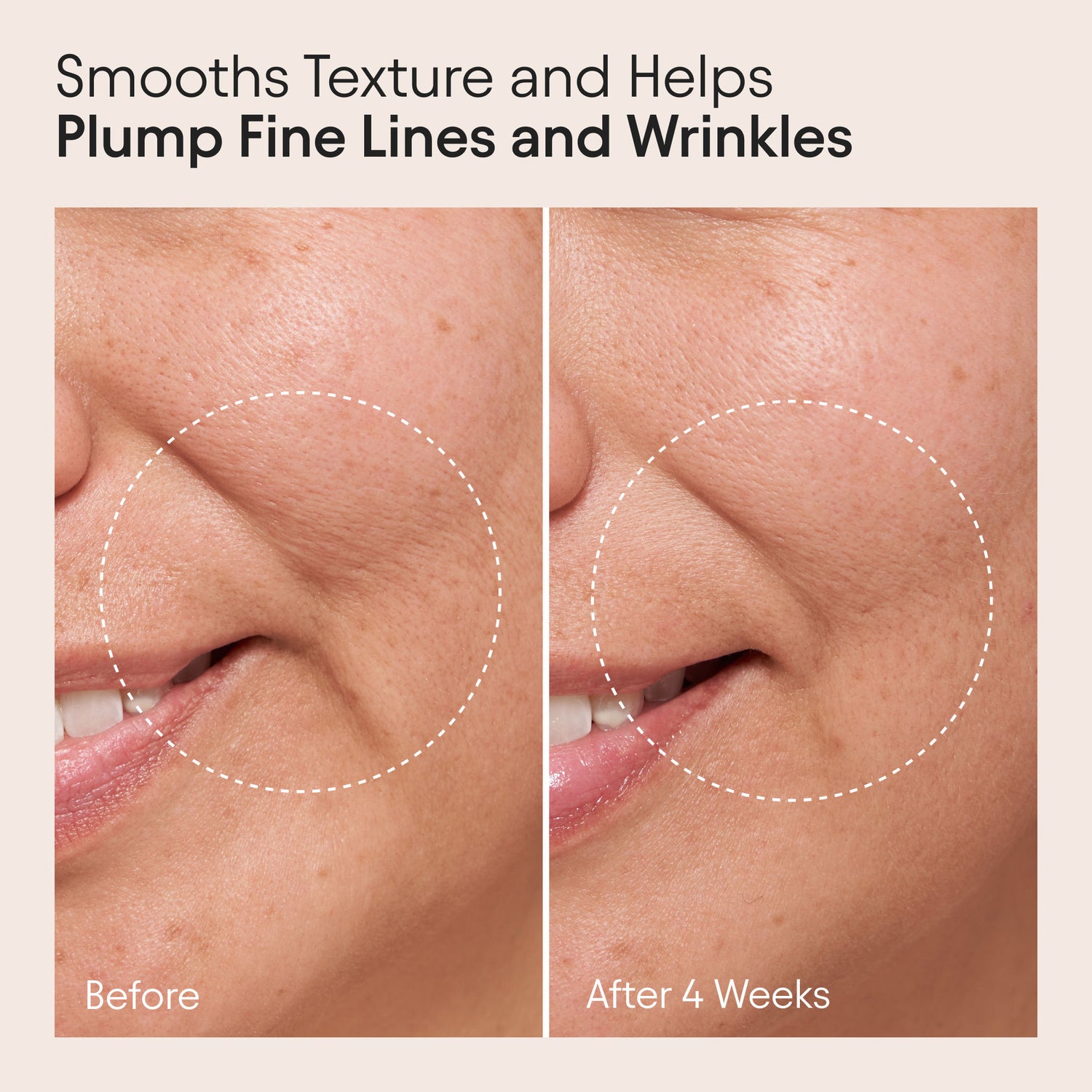 Before and after results of using Alpyn Beauty Clarifying Facial Oil with Retinol and Pink Algae