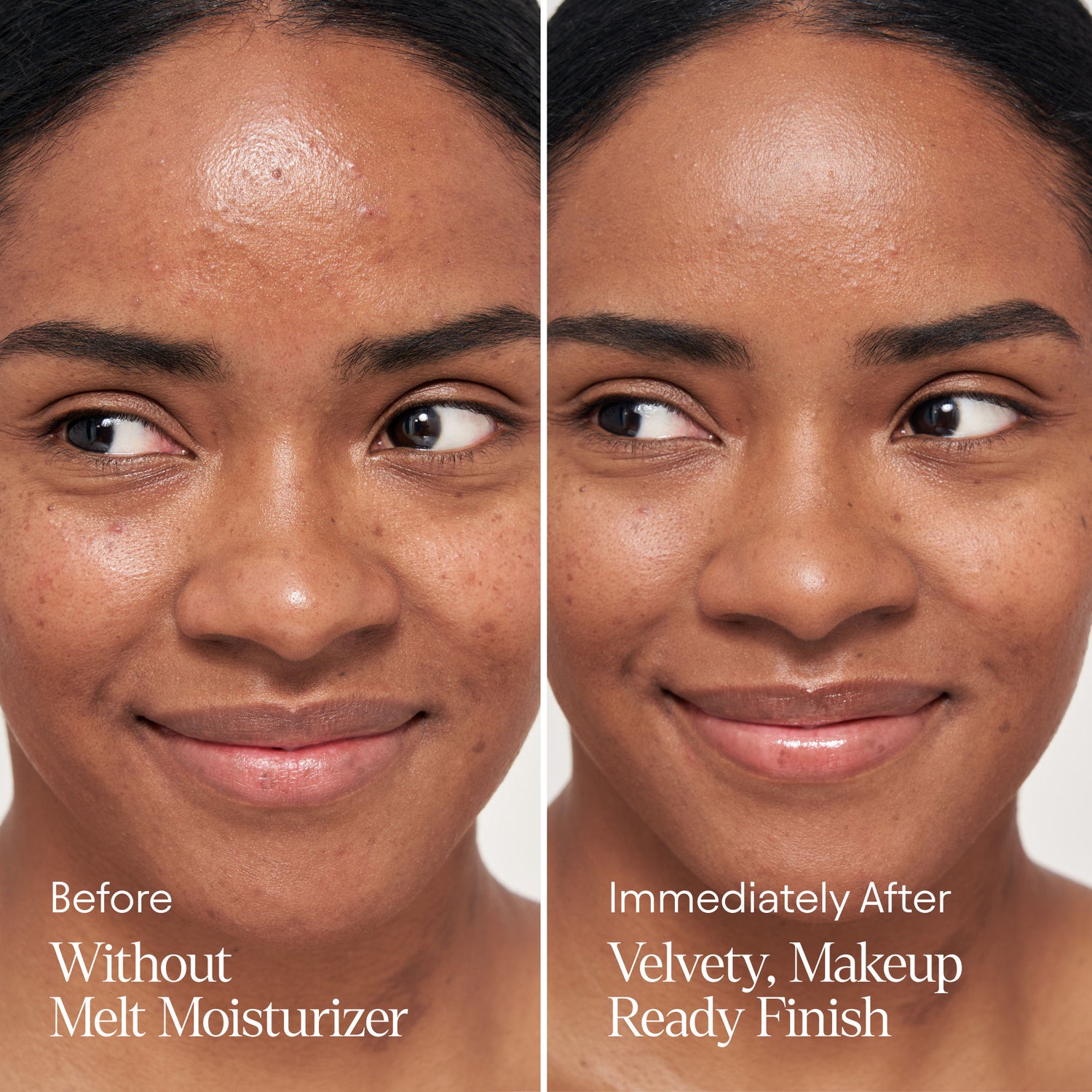 Before and after results of using Alpyn Beauty Melt Moisturizer for Firming, Plumping and Brightening