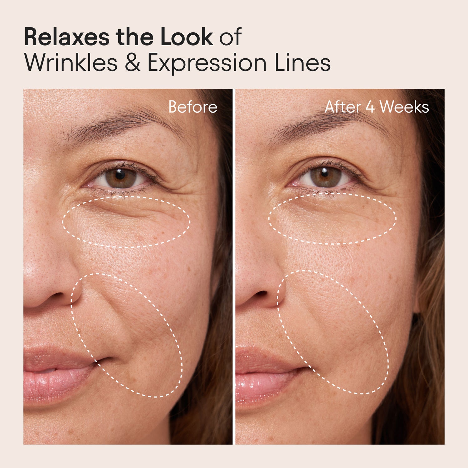 Before and after results of using Alpyn Beauty Barrier Repair Cream Moisturizer for Eczema, Wrinkle and Barrier Repair