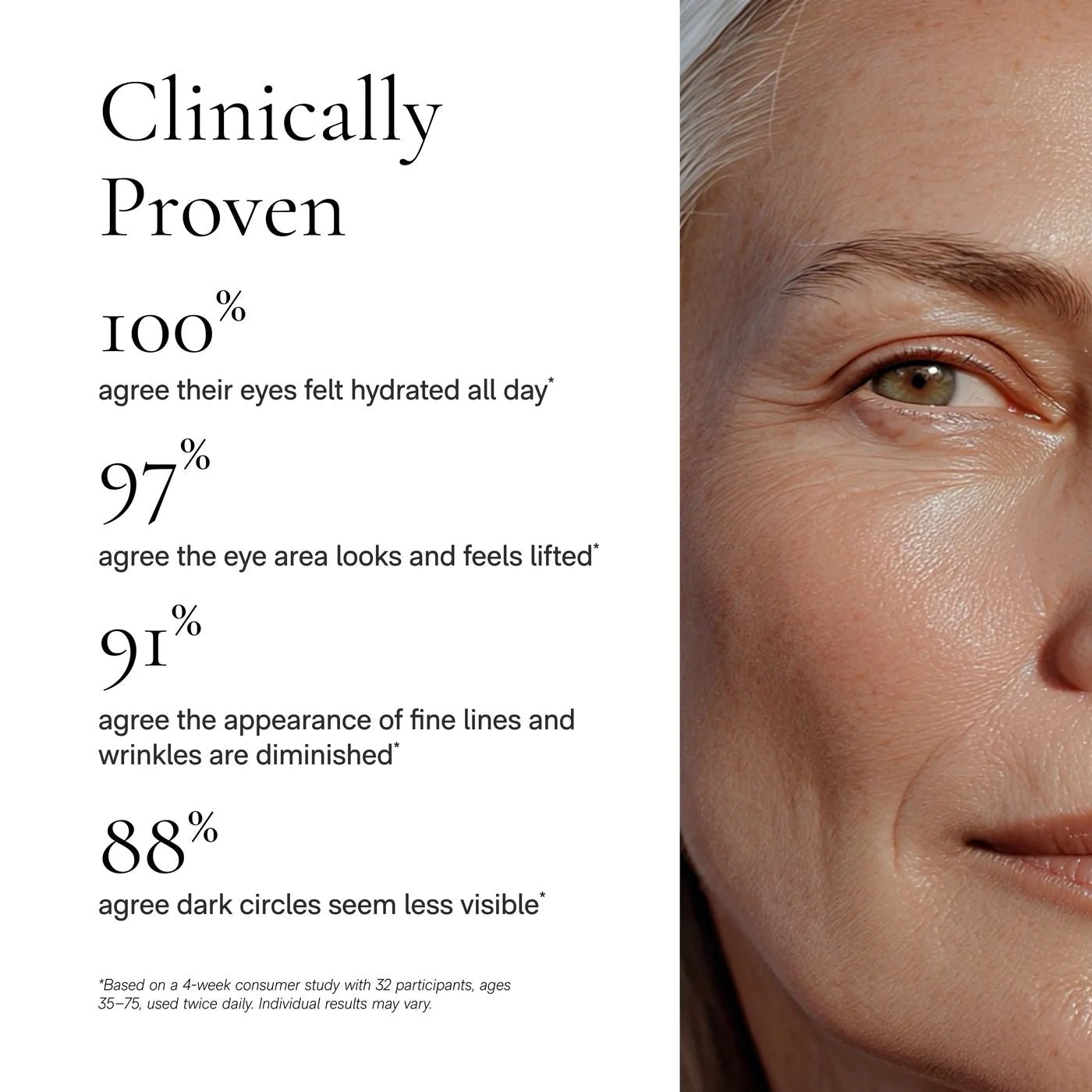 Before and after results of using Angela Caglia Skincare Cell Forté Eye Crème