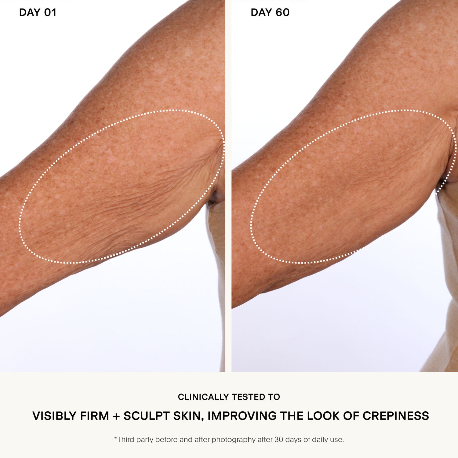 Before and after results of using U Beauty The Sculpt Arm Compound