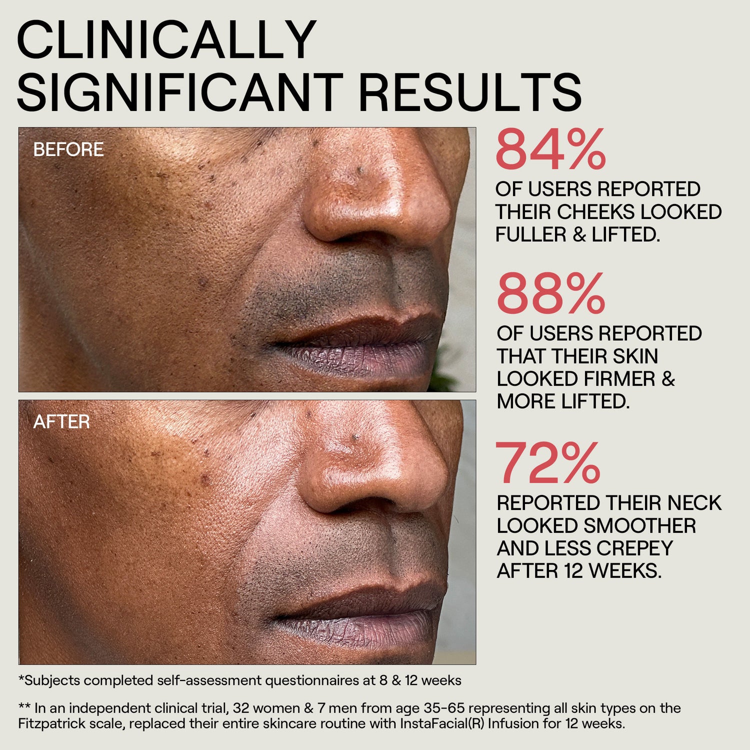 Information related to Dr. Diamond’s Metacine Instafacial Infusion Biomimetic Microcollagen Matrix
