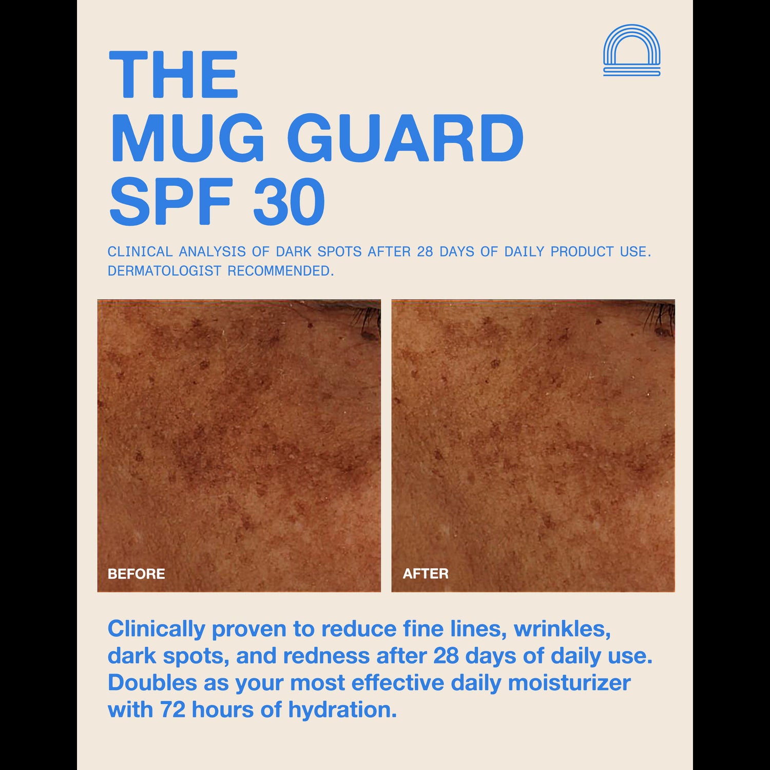 Information related to Dune The Mug Guard SPF 30