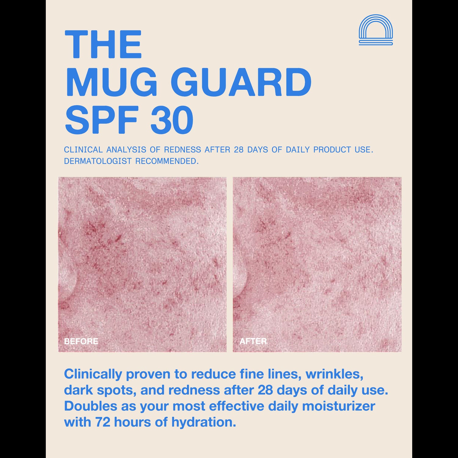 Information related to Dune The Mug Guard SPF 30