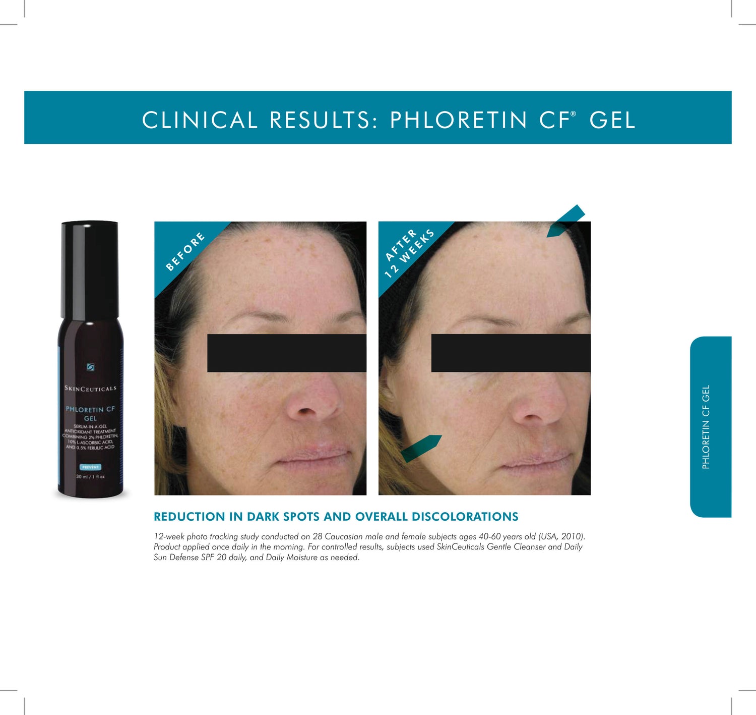 Before and after results of using SkinCeuticals Phloretin CF Gel