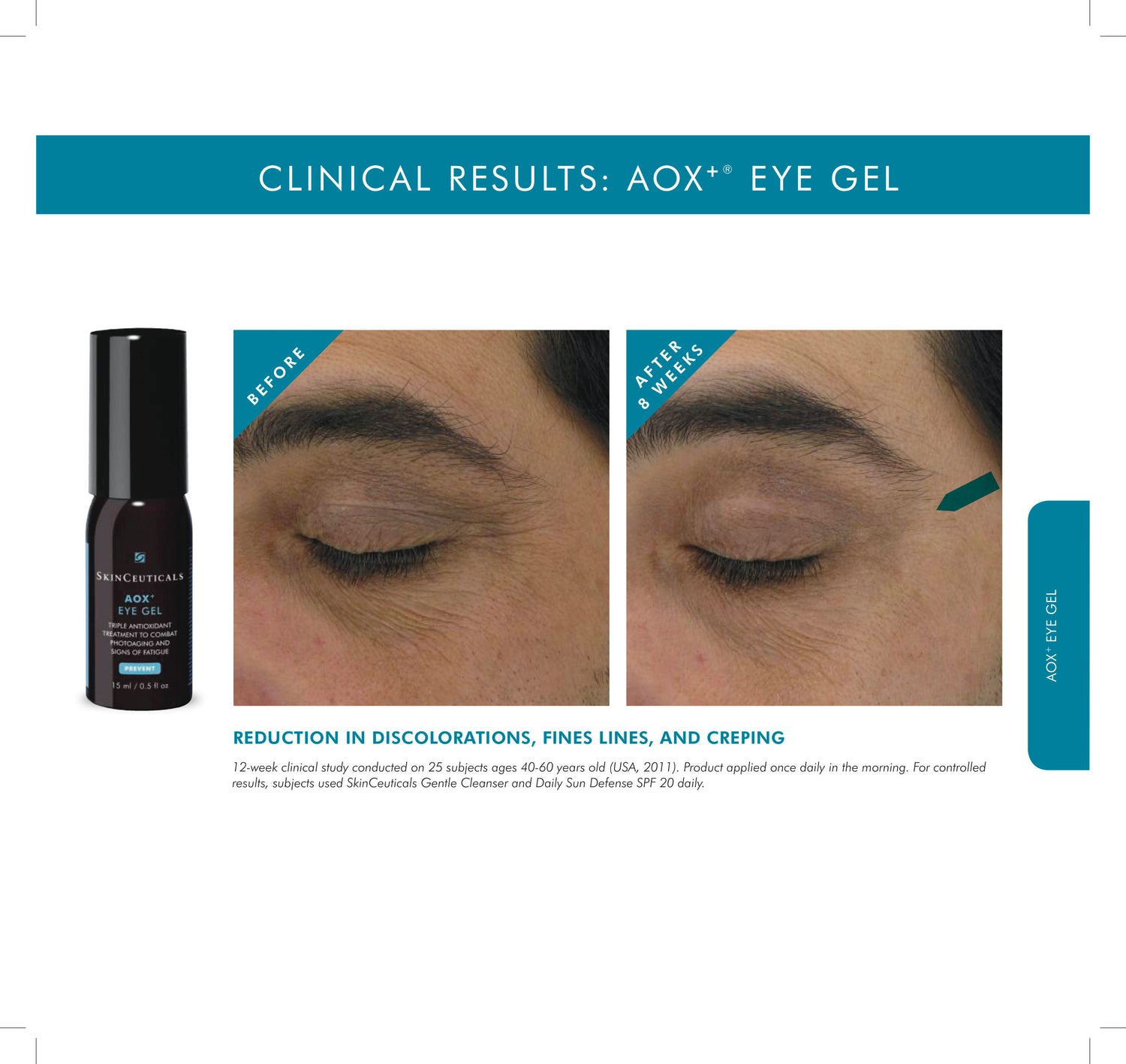 Before and after results of using SkinCeuticals Aox+ Eye Gel